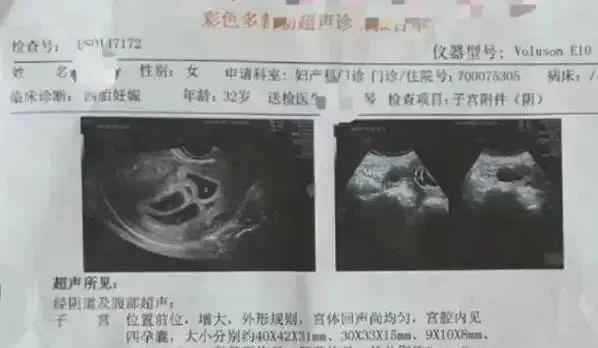 四胞胎+四胞胎！台州媳妇产后9个多月再怀孕，最终决定……